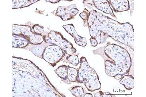 IHC analysis of RPN1 using anti-RPN1 antibody (ABIN7600447).