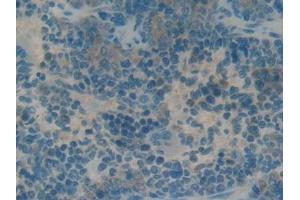 Immunohistochemistry (IHC) image for anti-Reprimo (RPRM) (AA 1-109) antibody (ABIN7438991)