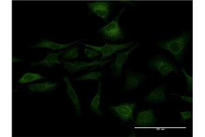 Immunofluorescence of monoclonal antibody to SFN on HeLa cell.