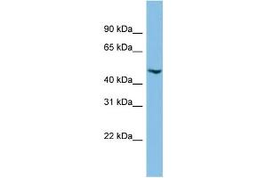 WB Suggested Anti-C17orf75 Antibody Titration: 0. (C17orf75 Antikörper  (Middle Region))