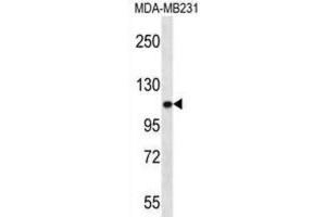Western Blotting (WB) image for anti-Actinin, alpha 3 (ACTN3) antibody (ABIN2996665) (ACTN3 Antikörper)