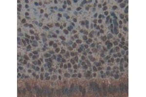 Used in DAB staining on fromalin fixed paraffin- embedded Kidney tissue (TRRAP Antikörper  (AA 3534-3770))