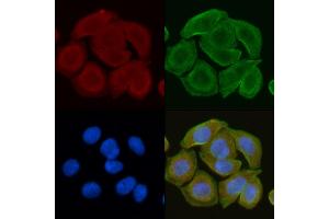 ABIN6260056 and ABIN6272251 staining Hela cells(30 min of UV treatment) by IF/ICC. (ARRDC4 Antikörper  (Internal Region))