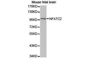 Western Blotting (WB) image for anti-Nuclear Factor of Activated T-Cells, Cytoplasmic, Calcineurin-Dependent 2 (NFAT1) antibody (ABIN1873890) (NFAT1 Antikörper)