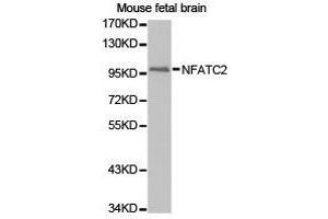 Western Blotting (WB) image for anti-Nuclear Factor of Activated T-Cells, Cytoplasmic, Calcineurin-Dependent 2 (NFAT1) antibody (ABIN1873890)