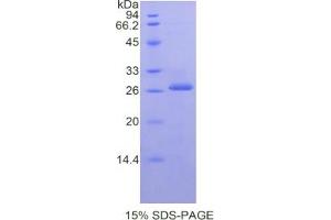 SDS-PAGE analysis of Mouse Kallikrein 3 Protein.