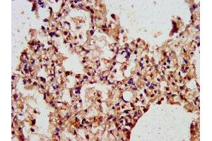 IHC image of ABIN7143473 diluted at 1:300 and staining in paraffin-embedded human lung tissue performed on a Leica BondTM system. (ARL1 Antikörper  (AA 2-181))