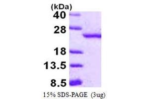 SDS-PAGE (SDS) image for Retinoblastoma Binding Protein 9 (RBBP9) (AA 1-186) protein (His tag) (ABIN667618)