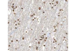 Immunohistochemistry (IHC) image for anti-Retinoic Acid Receptor, beta (RARB) (Internal Region) antibody (ABIN6264705)