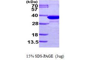 SDS-PAGE (SDS) image for Enoyl Coenzyme A Hydratase 1, Peroxisomal (ECH1) (AA 34-328) protein (His tag) (ABIN667209) (ECH1 Protein (AA 34-328) (His tag))