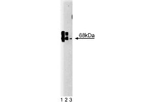 Western blot analysis of CaM Kinase Kinase on rat brain lysate. (CaM Kinase Kinase (AA 341-504) Antikörper)