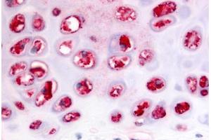 Immunohistochemistry (IHC) image for anti-ADAM Metallopeptidase with thrombospondin Type 1 Motif, 5 (ADAMTS5) (C-Term) antibody (ABIN1048296)