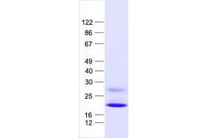 Western Blotting (WB) image for Interferon, alpha 6 (IFNA6) protein (His tag) (ABIN2723325)