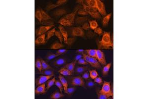 Immunofluorescence analysis of U-2 OS cells using F Rabbit mAb (ABIN7267150) at dilution of 1:100 (40x lens). (FABP1 Antikörper)