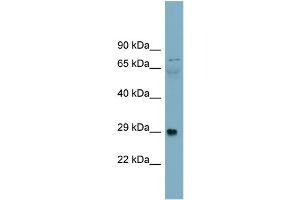 WB Suggested Anti-Alpha-DAG1 Antibody Titration:  0. (Dystroglycan Antikörper  (Middle Region))
