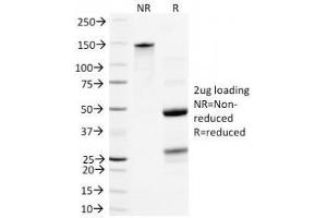 SDS-PAGE Analysis of Purified, BSA-Free Neurofilament Antibody (clone NR-4). (Neurofilament Antikörper)