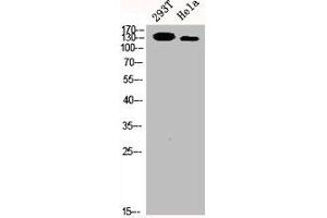Western Blot analysis of 293T HELA cells using p140Cap Polyclonal Antibody (SRCIN1 Antikörper  (Internal Region))