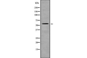 Western blot analysis SLC22A17 using K562 whole cell lysates (SLC22A17 Antikörper  (C-Term))