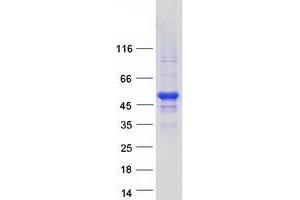 Validation with Western Blot (NAA30 Protein (Myc-DYKDDDDK Tag))