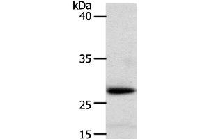 Western Blot analysis of Human liver cancer tissue using RARRES1 Polyclonal Antibody at dilution of 1:300