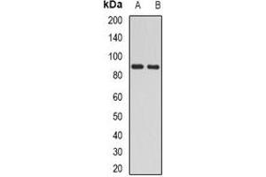 Western blot analysis of H6PD expression in mouse liver (A), mouse kidney (B) whole cell lysates. (Glucose-6-Phosphate Dehydrogenase Antikörper)