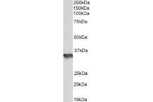 ABIN4902664 (1µg/ml) staining of Human Cerebellum lysate (35µg protein in RIPA buffer). (HS3ST1 Antikörper)