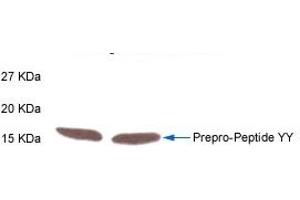 Western Blotting (WB) image for anti-Peptide YY (PYY) (AA 3-36) antibody (ABIN2871465)