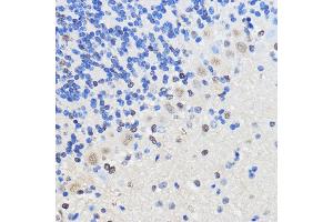 Immunohistochemistry (IHC) image for anti-Heterogeneous Nuclear Ribonucleoprotein U (Scaffold Attachment Factor A) (HNRNPU) (AA 608-825) antibody (ABIN1680323)