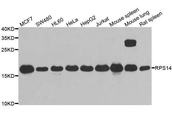 RPS14 Antikörper  (AA 1-151)