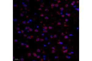 Immunofluorescence of paraffin embedded rat corpus striatum using GPR137A (ABIN7073996) at dilution of 1: 6500 (400x lens) (GPR137 Antikörper)
