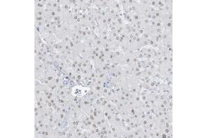 Immunohistochemical staining of human liver with ZFP64 polyclonal antibody  shows nuclear positivity in hepatocytes at 1:200-1:500 dilution. (ZFP64 Antikörper)