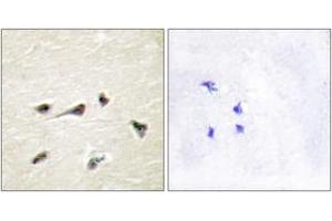 Immunohistochemistry analysis of paraffin-embedded human brain tissue, using AKAP12 Antibody. (AKAP12 Antikörper  (AA 301-350))