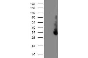 HEK293T cells were transfected with the pCMV6-ENTRY control (Left lane) or pCMV6-ENTRY ERCC1 (Right lane) cDNA for 48 hrs and lysed. (ERCC1 Antikörper)