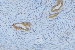 ABIN6268669 at 1/100 staining Human uterus tissue by IHC-P. (IL-5 Antikörper  (Internal Region))