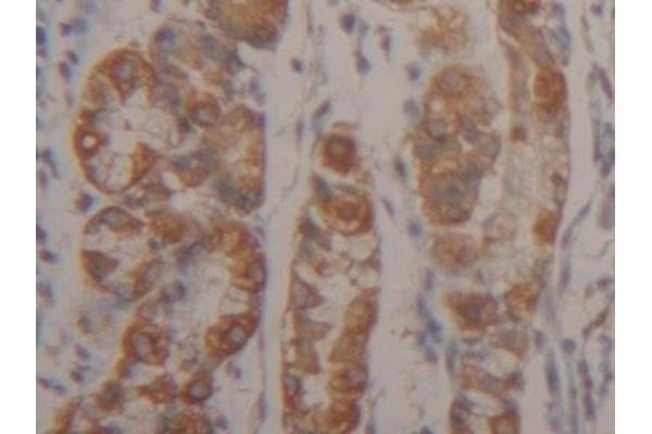 Cytokeratin 18 Antikörper  (AA 238-396)