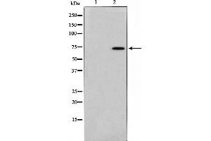Western blot analysis on 293 cell lysate using TAF6L Antibody，The lane on the left is treated with the antigen-specific peptide.