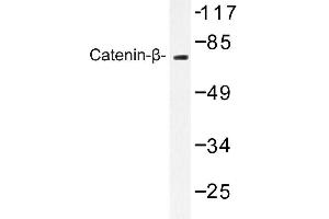 Image no. 1 for anti-Catenin (Cadherin-Associated Protein), beta 1, 88kDa (CTNNB1) antibody (ABIN272110) (CTNNB1 Antikörper)