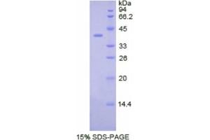 SDS-PAGE analysis of Human CSF2Rb Protein. (CD131 Protein)