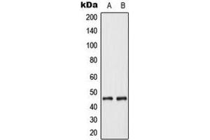 Western blot analysis of Cytokeratin 18 expression in MCF7 (A), Jurkat (B) whole cell lysates. (Cytokeratin 18 Antikörper  (N-Term))