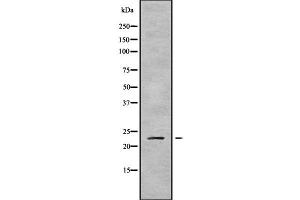 Western blot analysis of RAB43 using K562 whole cell lysates (RAB43 Antikörper  (Internal Region))