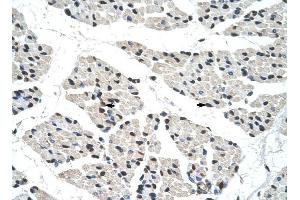 RALY antibody was used for immunohistochemistry at a concentration of 4-8 ug/ml to stain Skeletal muscle cells (arrows) in Human Muscle.