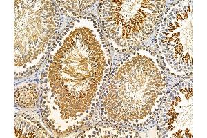 ABIN7095842 and ABIN7099904 at 1/100 staining rat testis tissue by IHC-P. (SLC44A3 Antikörper)