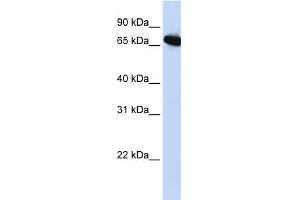 WB Suggested Anti-DLX4 Antibody Titration:  0. (DLX4 Antikörper  (Middle Region))