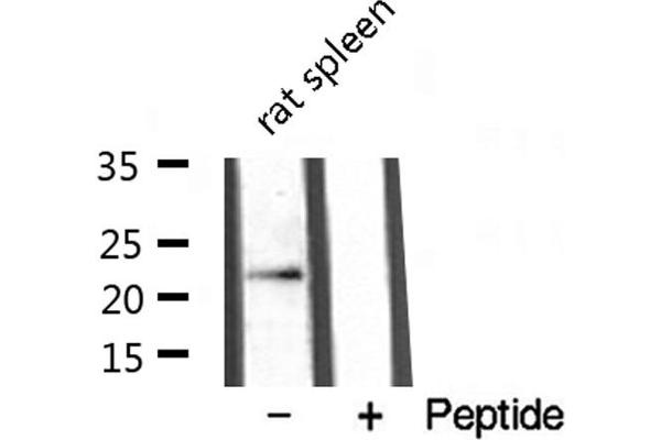 LTB Antikörper  (C-Term)