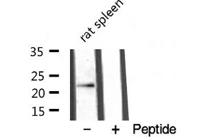 Western blot analysis of extracts from rat spleen , using TNFC antibody. (LTB Antikörper  (C-Term))
