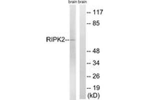 Western blot analysis of extracts from rat brain cells, using RIPK2 (Ab-176) Antibody. (RIPK2 Antikörper  (AA 146-195))