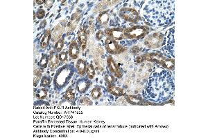 Immunohistochemistry (IHC) image for anti-Pyruvate Kinase, Liver and RBC (PKLR) (N-Term) antibody (ABIN310205) (PKLR Antikörper  (N-Term))