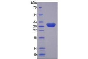 SDS-PAGE analysis of Human Laminin alpha 4 Protein. (LAMa4 Protein)