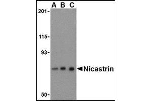 Western blot analysis of Nicastrin in mouse brain tissue lysate with this product at (A) 0. (Nicastrin Antikörper  (C-Term))