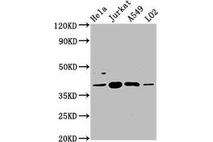 Western Blot Positive WB detected in: Hela whole cell lysate, Jurkat whole cell lysate, A549 whole cell lysate, LO2 whole cell lysate All lanes: SHARPIN antibody at 5. (SHARPIN Antikörper  (AA 82-171))